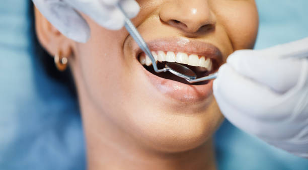 Best Emergency Treatment for Oral Infections in Winterset, IA